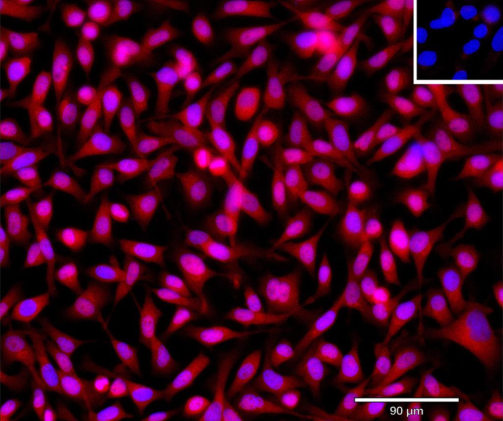 Ankyron ABL1_HUMAN Clone DR40956