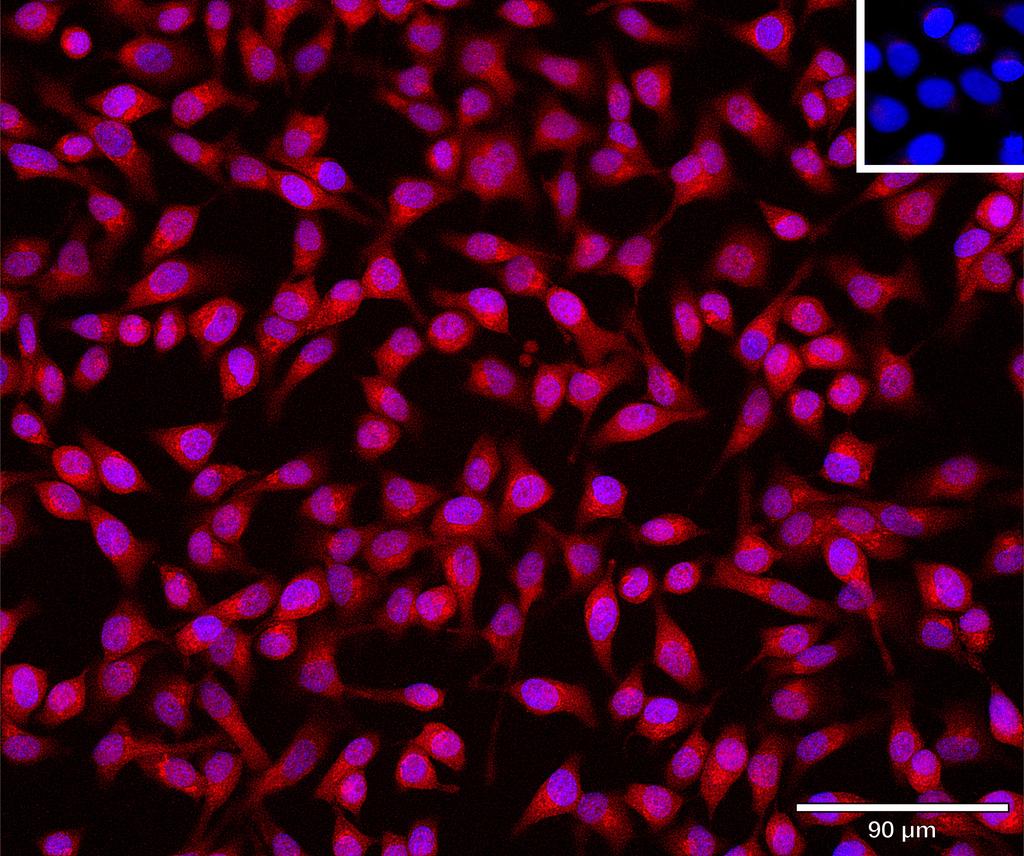 Ankyron ABL1_HUMAN Clone DR40960