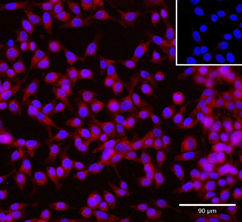 Ankyron ACBD6_HUMAN Clone CU30944