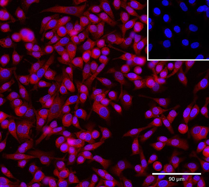 Ankyron ACBD6_HUMAN Clone CU30955