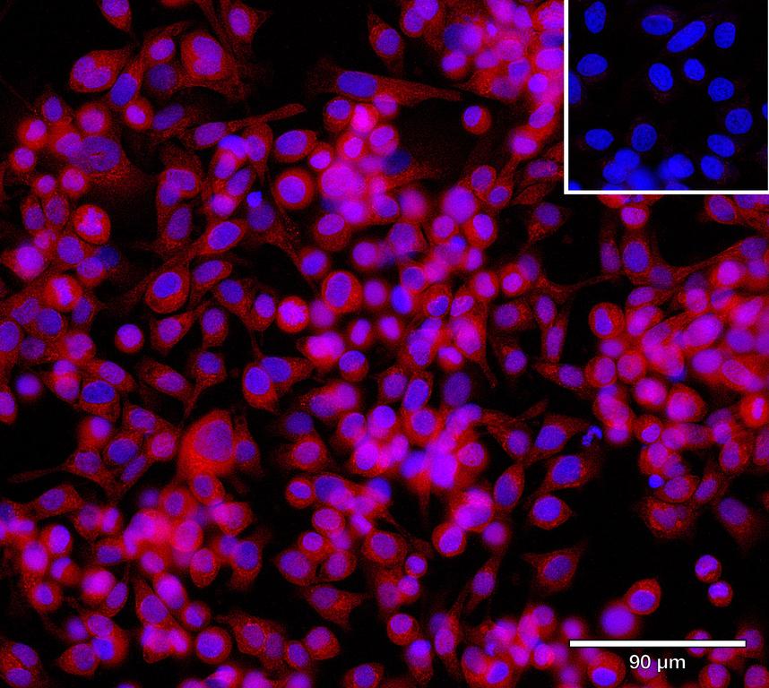 Ankyron ACBD6_HUMAN Clone CU30934