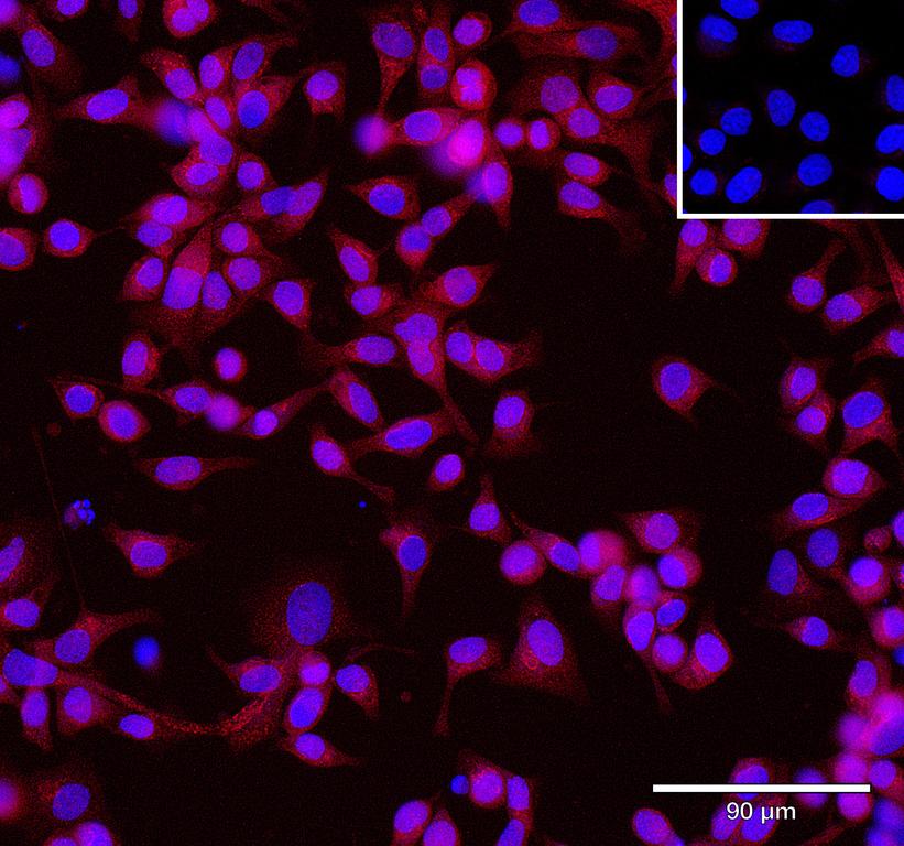 Ankyron ACBD6_HUMAN Clone CU30936