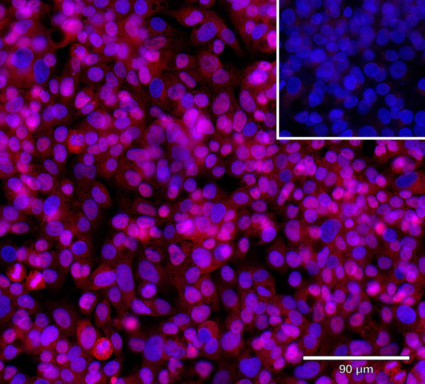 Ankyron ACBD7_HUMAN Clone AR40696