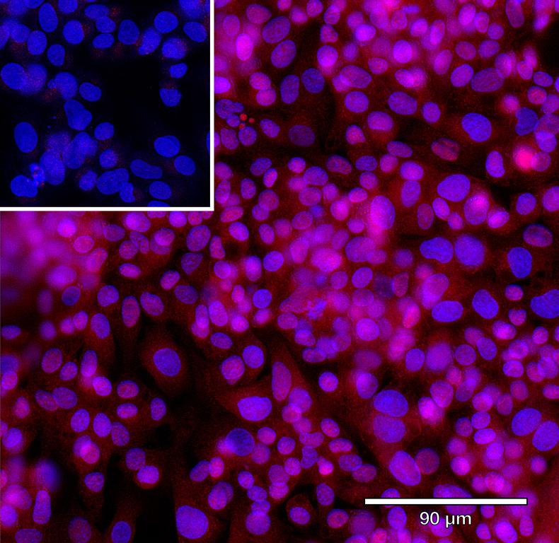 Ankyron ACSL1_HUMAN Clone CN40121