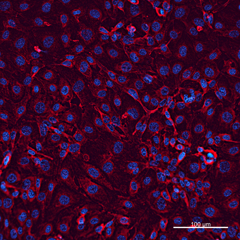 Ankyron ACTB_HUMAN Clone CS30852
