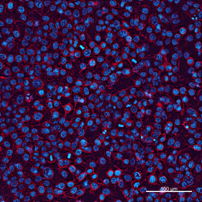 Ankyron ACTB_HUMAN Clone CS30862