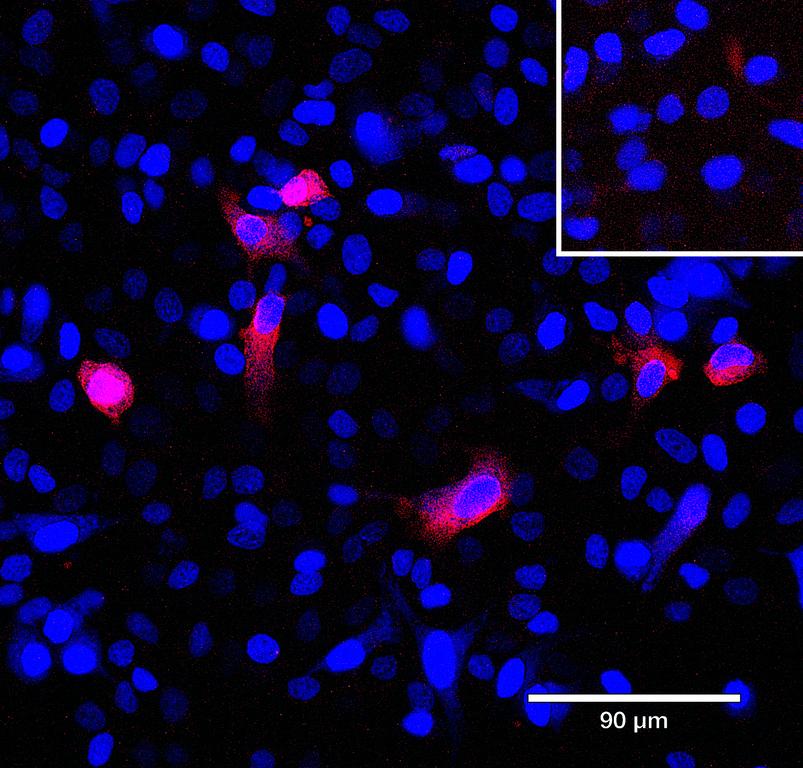 Ankyron ACV1B_HUMAN Clone AL40178