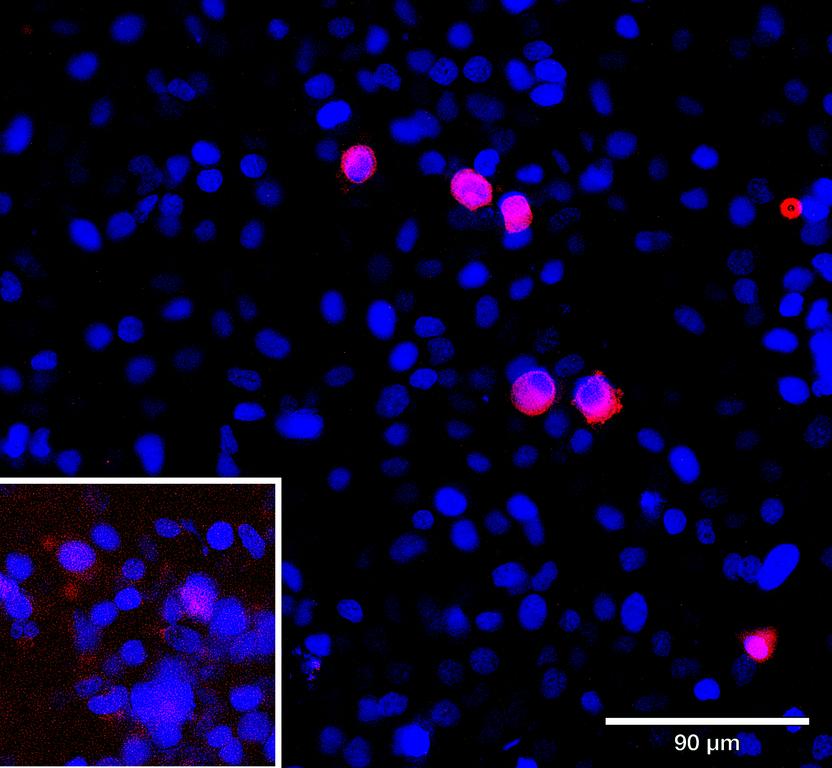 Ankyron ACV1B_HUMAN Clone AL40173