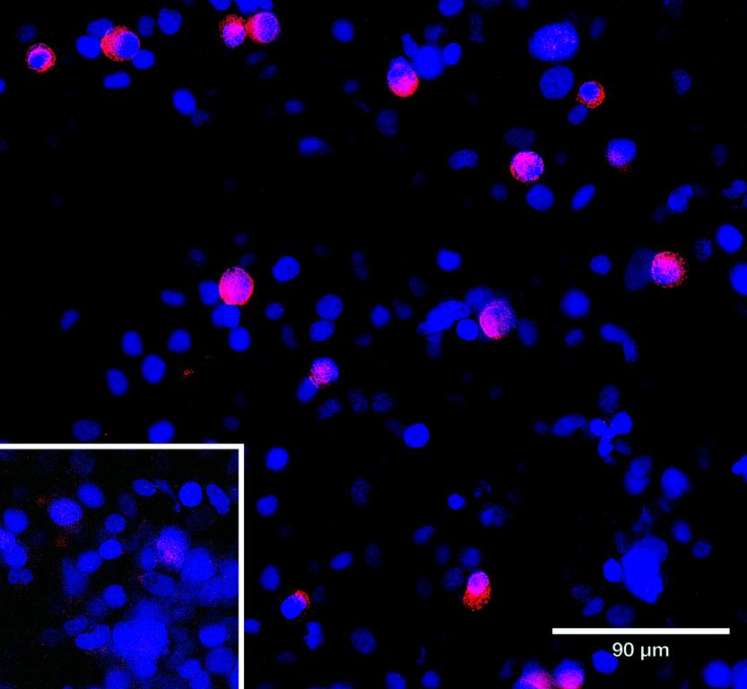 Ankyron ACV1B_HUMAN Clone AL40167