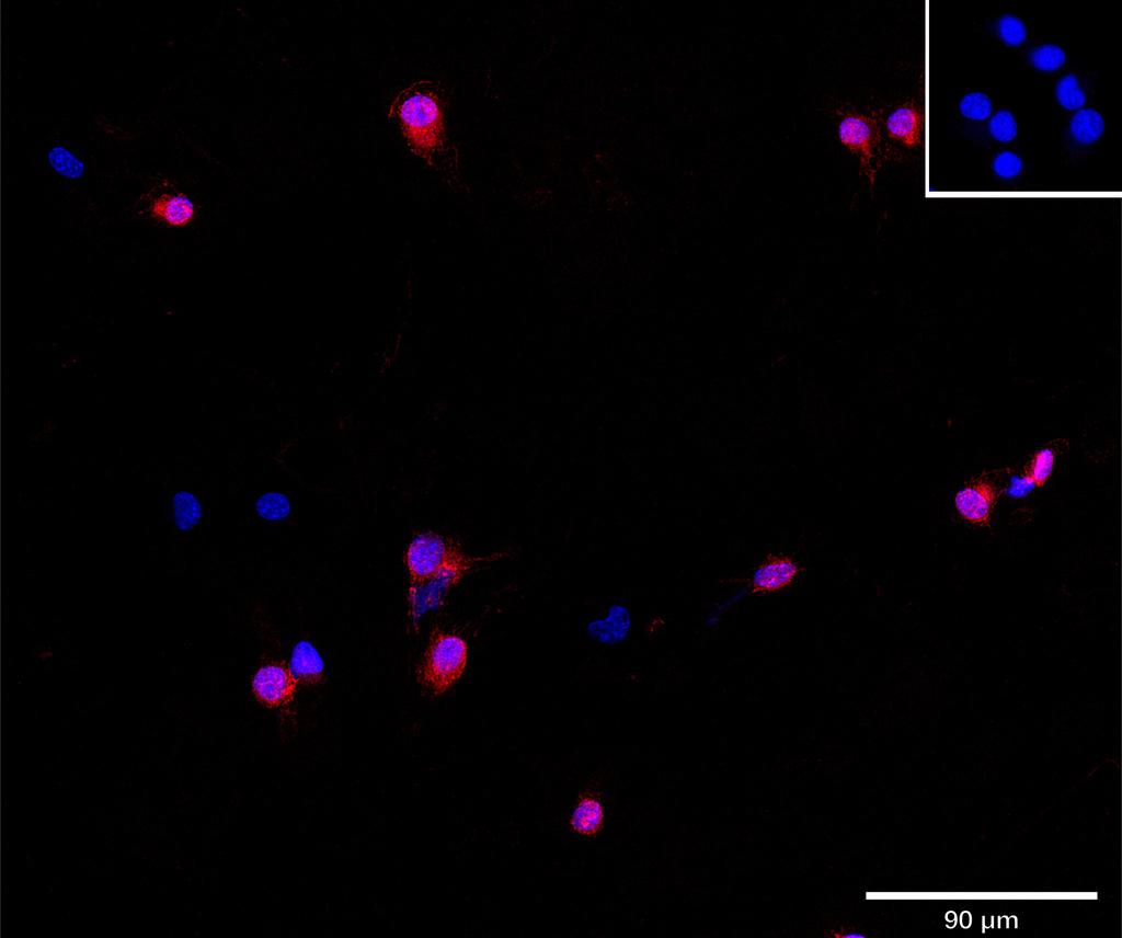 Ankyron ACVL1_MOUSE Clone AS41064