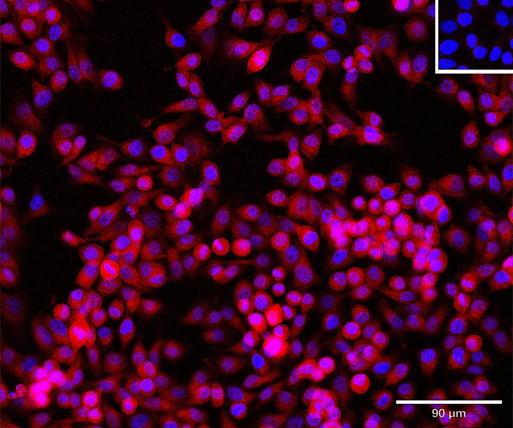 Ankyron ACYP1_HUMAN Clone CU30193