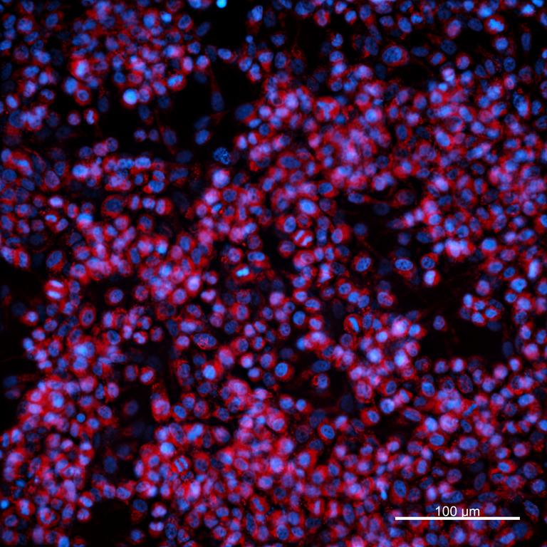 Ankyron ADA11_HUMAN Clone FU40132