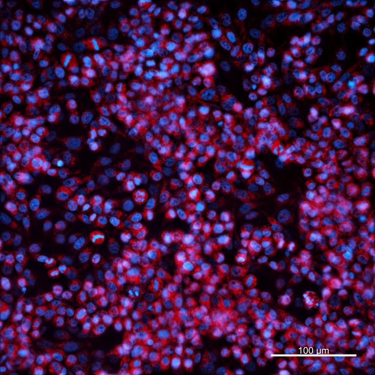 Ankyron ADA12_HUMAN Clone AR40415