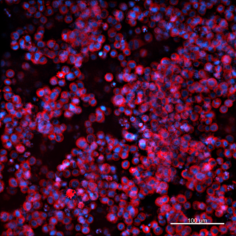 Ankyron ADA12_HUMAN Clone AR40427