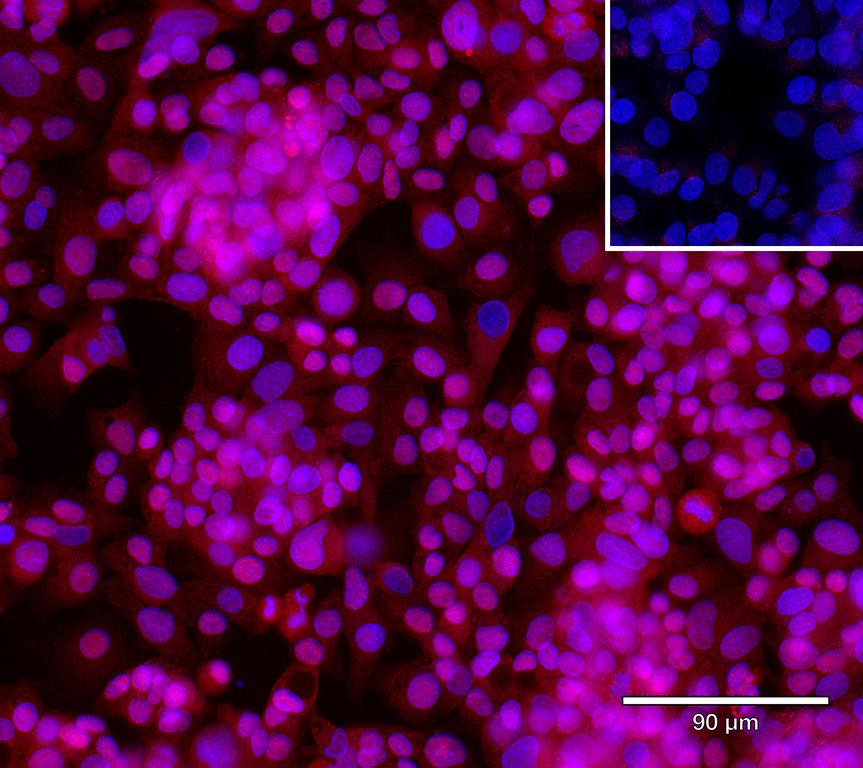 Ankyron ADA15_HUMAN Clone AU41262