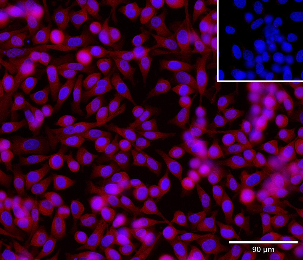 Ankyron ADA15_HUMAN Clone AU41284