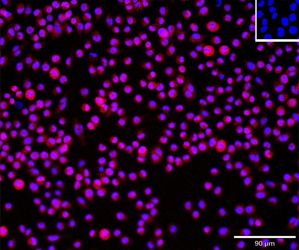 Ankyron ADA15_MOUSE Clone CU30125