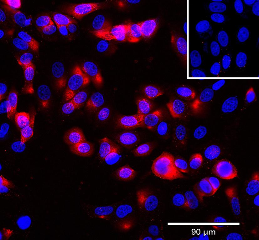Ankyron AGRE5_HUMAN Clone AU40747