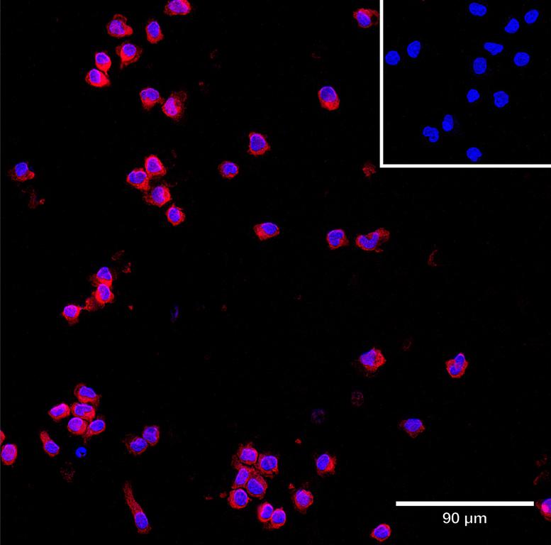 Ankyron AIF1_HUMAN Clone CU30590