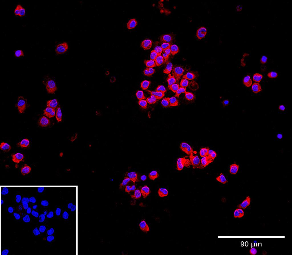 Ankyron AIF1_HUMAN Clone CU30595