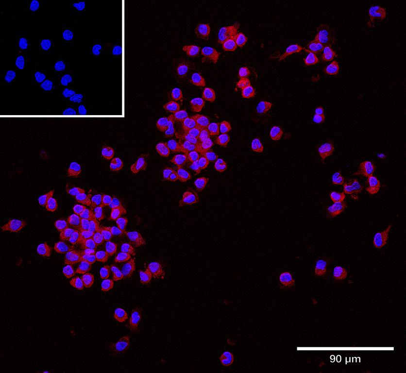 Ankyron AIF1_HUMAN Clone CU30596