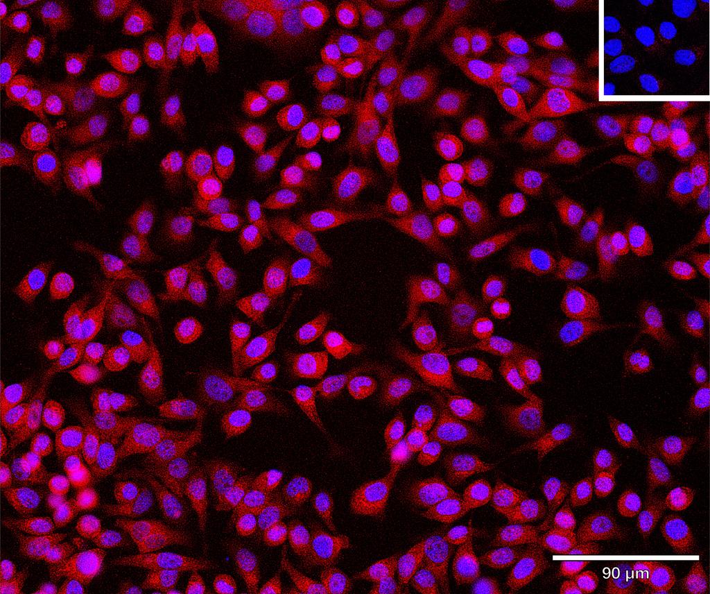 Ankyron AIM2_HUMAN Clone CU30117