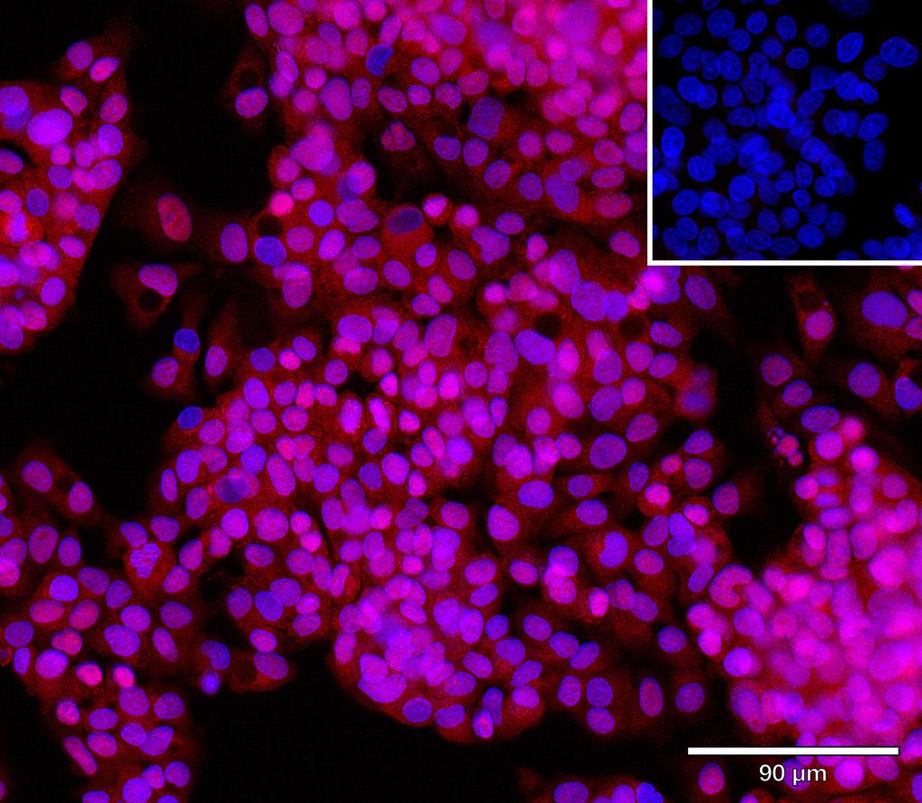 Ankyron AK1C4_HUMAN Clone CU30349