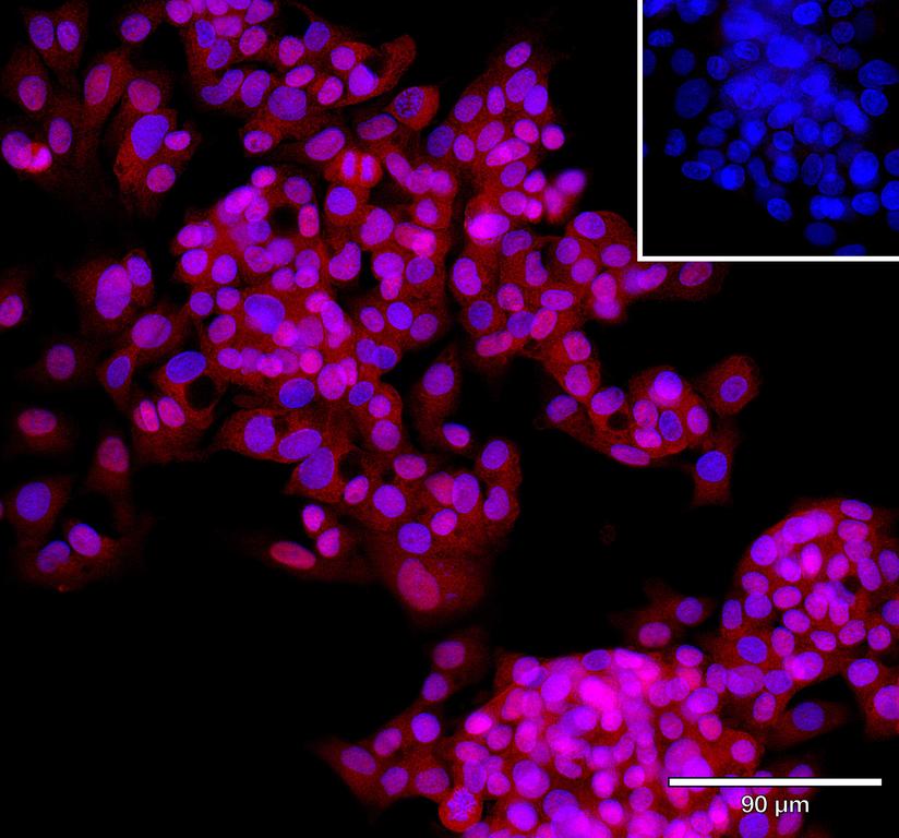 Ankyron AK1C4_HUMAN Clone CU30354