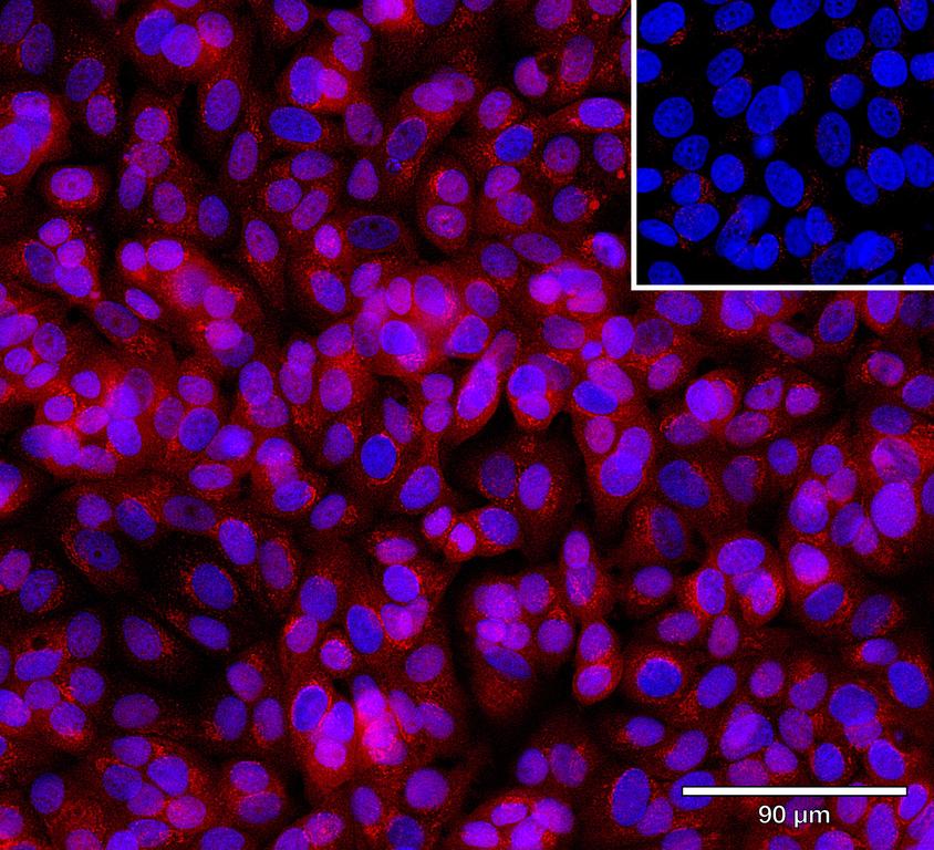 Ankyron AKT3_HUMAN Clone CD30149