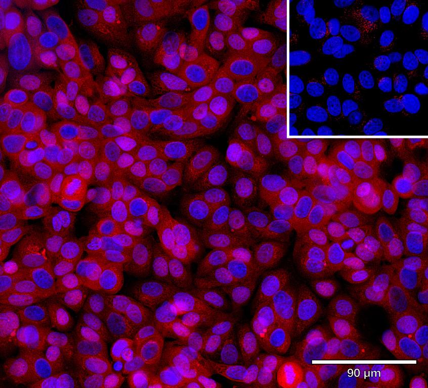 Ankyron AKT3_HUMAN Clone CD30151