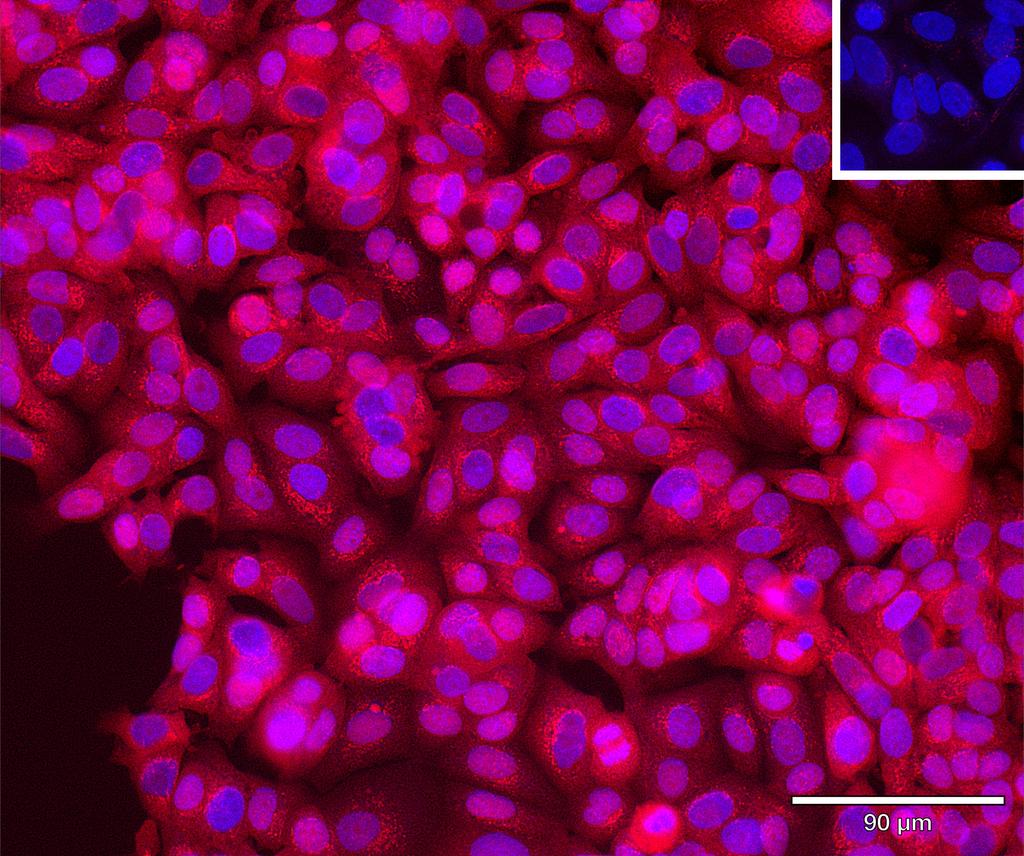 Ankyron AKT3_HUMAN Clone BP40149
