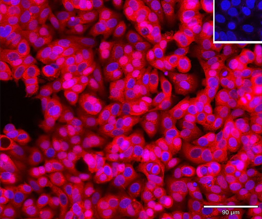 Ankyron AKT3_HUMAN Clone BP40152