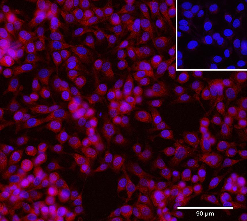 Ankyron ALDR_HUMAN Clone CU30253