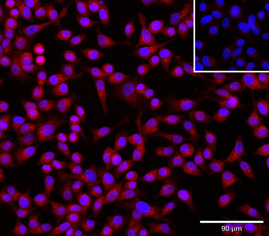 Ankyron ANGL3_HUMAN Clone AR40511