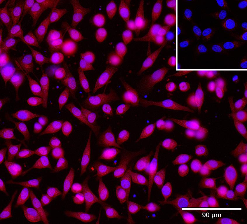 Ankyron ANGL3_HUMAN Clone AR40510