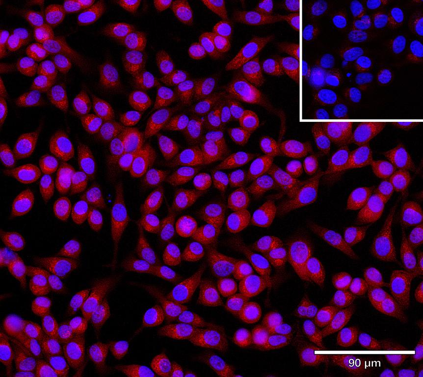 Ankyron ANGL3_HUMAN Clone AR40512