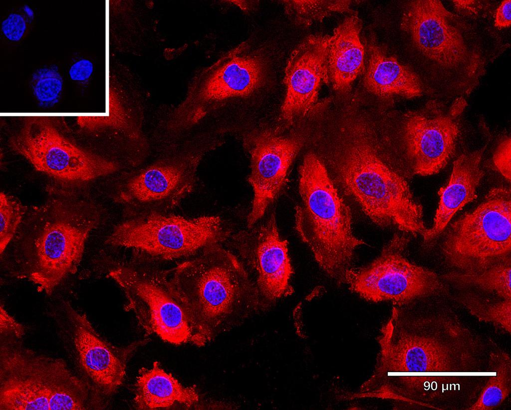 Ankyron ANGP2_HUMAN Clone BD40163