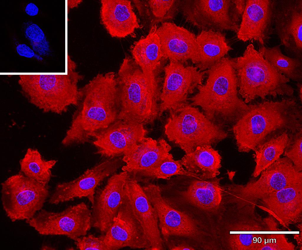Ankyron ANGP2_HUMAN Clone BD40162
