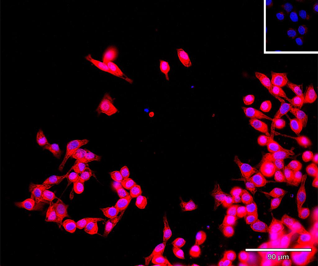 Ankyron ANGP4_HUMAN Clone CA30309