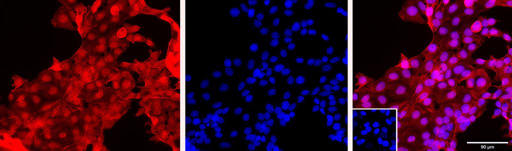 Ankyron AP2C_HUMAN Clone CN40234
