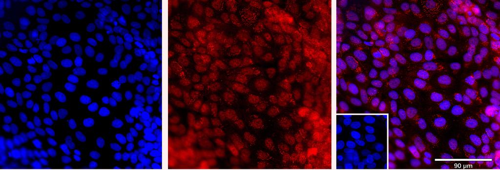 Ankyron AP2C_HUMAN Clone CN40236
