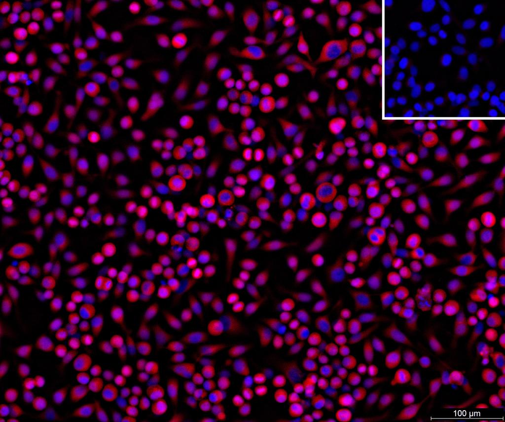 Ankyron APCD1_HUMAN Clone CY40341