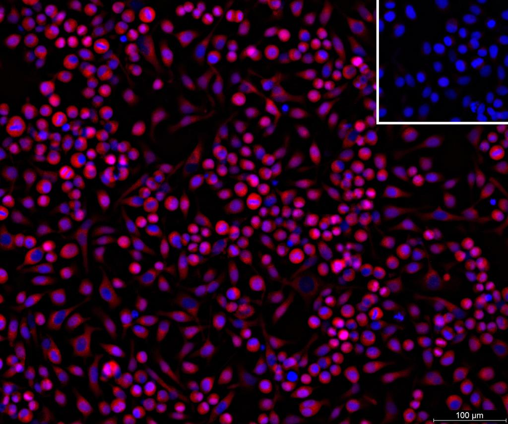 Ankyron APCD1_HUMAN Clone CY40336