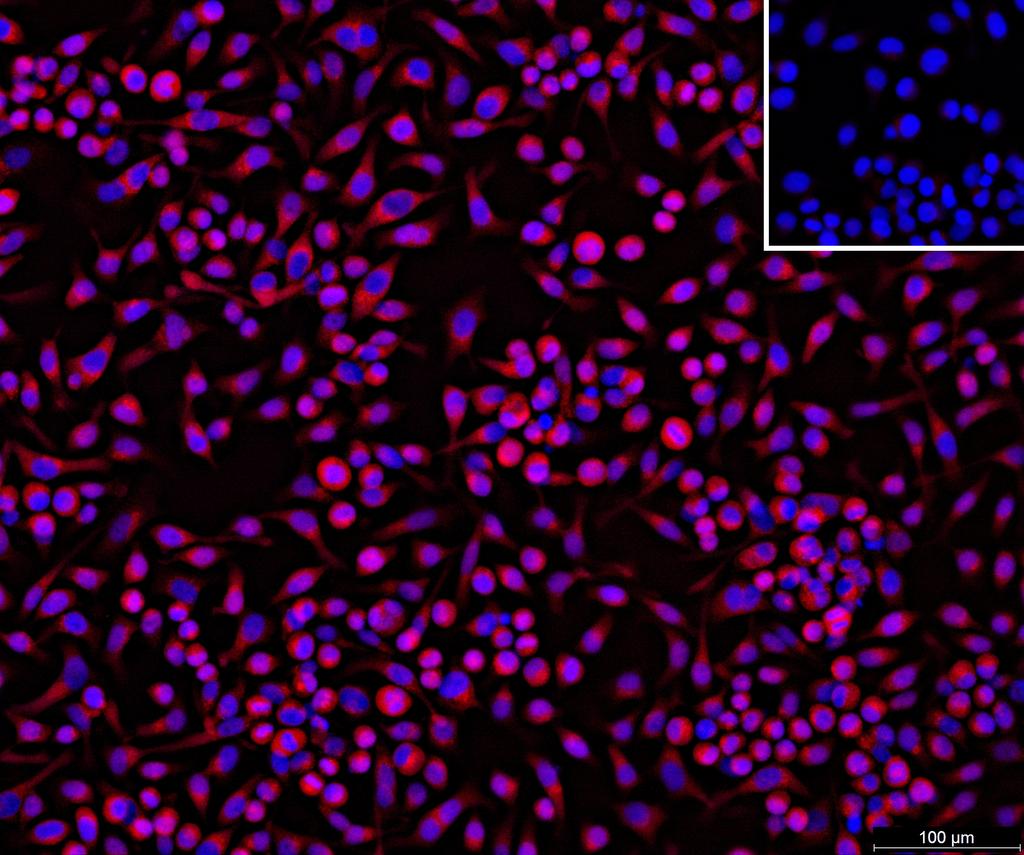 Ankyron APCD1_HUMAN Clone CY40337