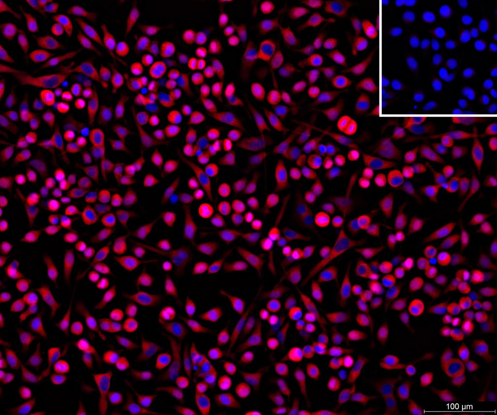 Ankyron APCD1_HUMAN Clone CY40345
