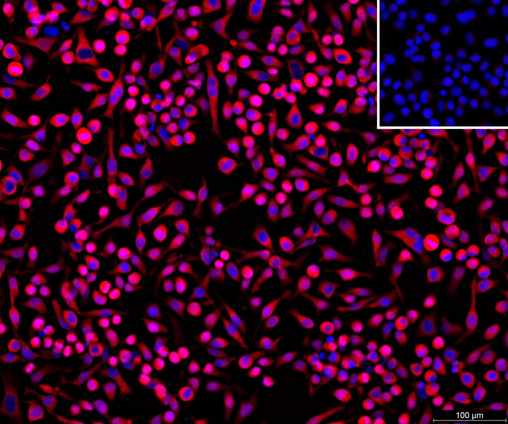 Ankyron APCD1_HUMAN Clone CY40338