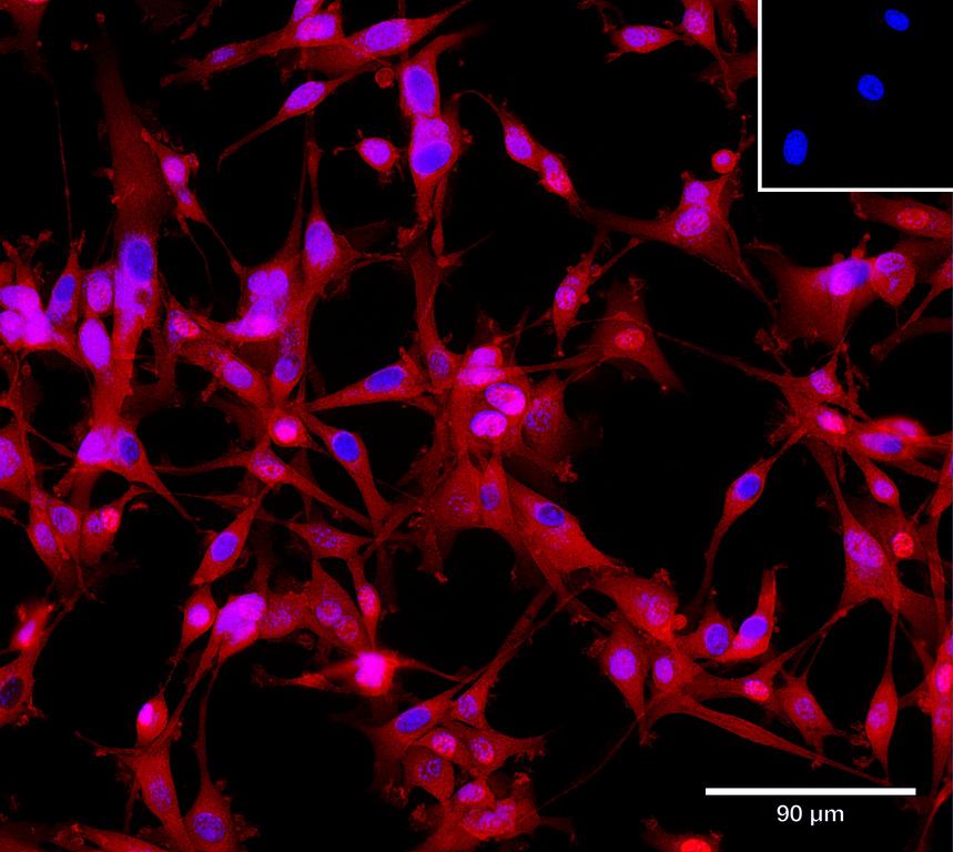 Ankyron APLP1_HUMAN Clone AG40101