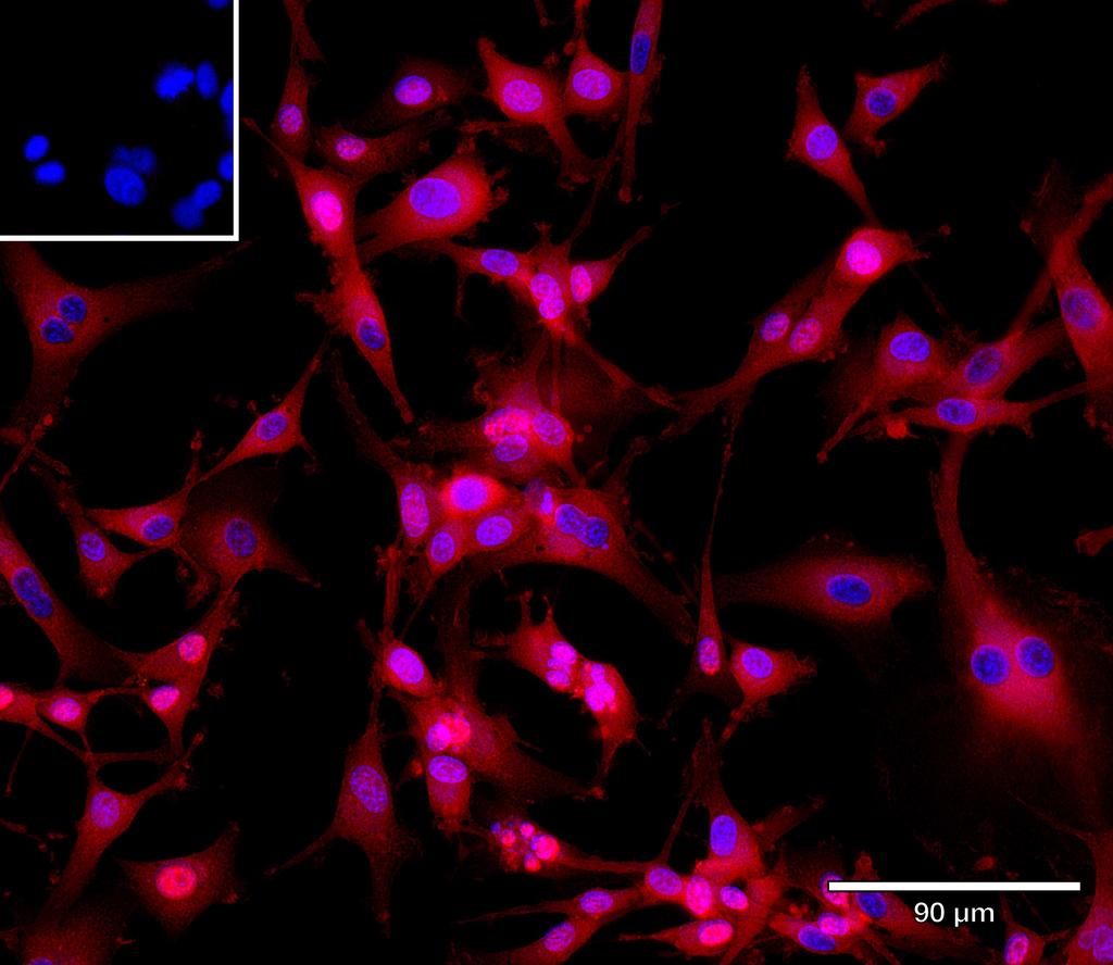 Ankyron APLP1_HUMAN Clone AG40102