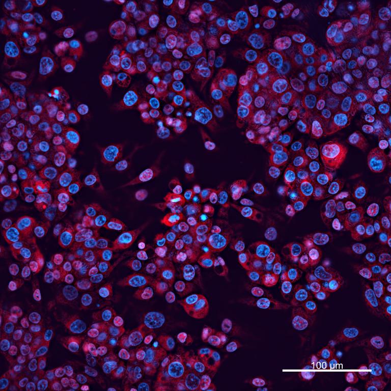 Ankyron APOA1_HUMAN Clone CI30551