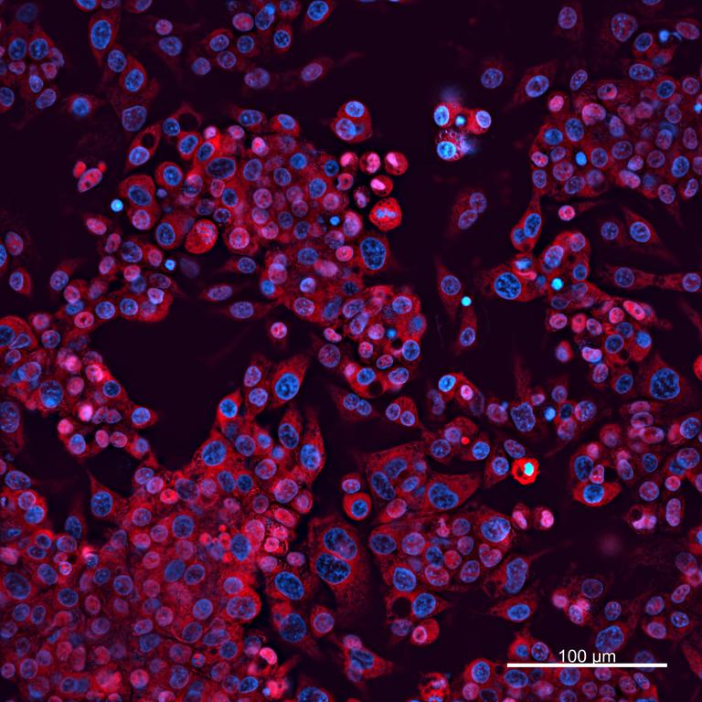 Ankyron APOA1_HUMAN Clone CI30531